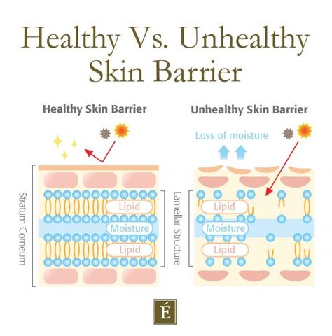 What Is Your Skin Barrier & How To Protect It | Eminence Organic Skin Care Skin Care Education, Skin Education, Skincare Education, Skin Anatomy, Skin Facts, Eminence Organic Skin Care, Skin Science, Skin Care Steps, Dry Skin Care