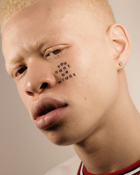 Portrait Series Highlights Beauty of Albinism, Birthmarks & Other Skin Conditions A Level Photography, Glow Skin, Fashion Institute, Aesthetic People, Shooting Photo, Beauty Standards, Be Different, Skin Conditions, Black Is Beautiful