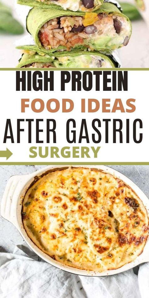 High Protein Foods For Gastric Bypass Patients Gastric Bypass Meal Plan, High Protein Bariatric Recipes, Full Liquid Diet, Liquid Diet Recipes, Bariatric Recipes Sleeve, Gastric Bypass Recipes, Bariatric Meals, Soft Foods Diet, Low Carb Foods