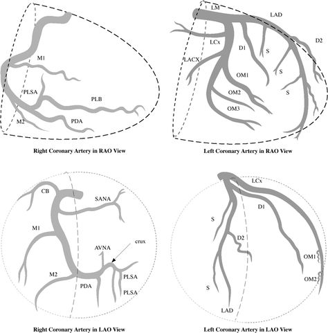 Cath Cath Lab Nurse, Cath Lab Nursing, Cardiac Cath, Cardiac Assessment, Cardiovascular Nursing, Heart Catheterization, Cardiac Anatomy, Cardiac Dysrhythmias Nursing, Cardiothoracic Surgery