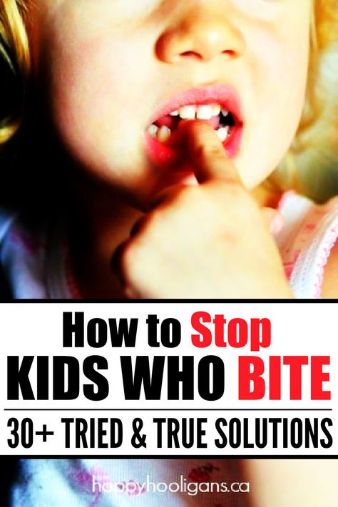 What to do when children bite, and how to stop biting behaviour. 30+ tried and true solutions from parents, teachers and carers. Biting In Preschool, Childcare Teacher, Happy Hooligans, Prepare For Labor, Notes To Parents, Toddler Ideas, Toddler Biting, Learning Tips, Toddler Sensory