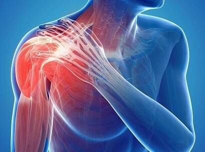 Rotator Cuff Injury Exercises, Osteoporosis Symptoms, Bursitis Shoulder, Shoulder Rehab Exercises, Men's Health Magazine, Rotator Cuff Exercises, Shoulder Pain Exercises, Shoulder Dislocation, Shoulder Rehab