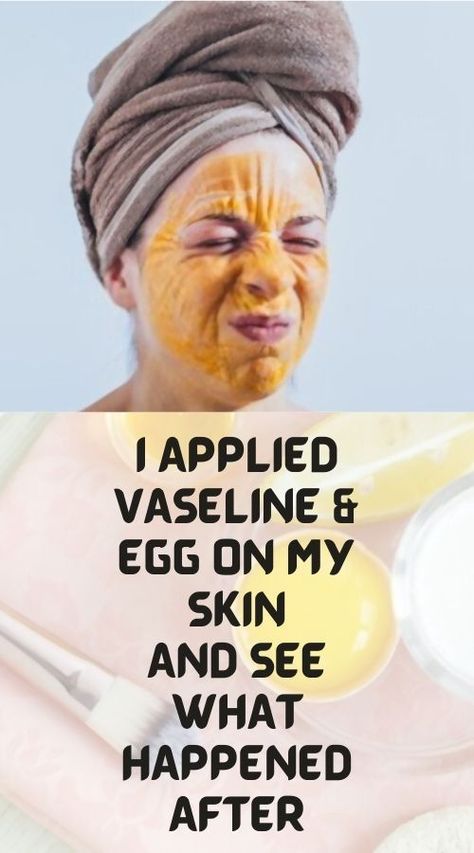 Vaseline And Egg Face Mask, Egg Yolk Face Mask Anti Wrinkle, Vaseline On Face Overnight, Is Vaseline Good For Your Face, Vaseline Makeup, Primer For Sensitive Skin, Vaseline Uses For Face, Vaseline For Face, Wrinkles Remedies Face