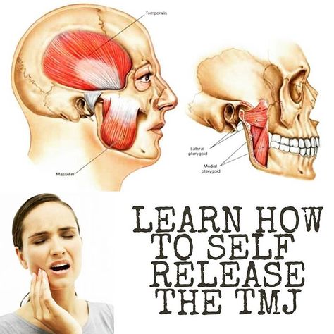 HOW TO SELF RELEASE YOUR TMJ External and Internal Techniques . Swipe LEFT for the 4 📽 . I had an overwhelming response 🙌 to create these… Jaw Exercises Tmj, Tmj Relief Remedies, Tmj Massage, Jaw Pain Relief, Punkty Spustowe, Tmj Relief, Jaw Exercises, Soap Note, Pain Relief Remedies