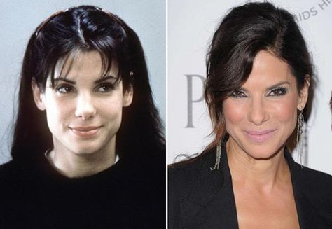 Sandra Bullock Plastic Surgery - Obvious Nose Job - http://plasticsurgerytalks.com/sandra-bullock-plastic-surgery/ Sandra Bullock Plastic Surgery, Plastic Surgery Gone Wrong, Celebrity Plastic Surgery, Under The Knife, Classic Movie Stars, Nose Job, After Pictures, Sandra Bullock, Before And After Pictures