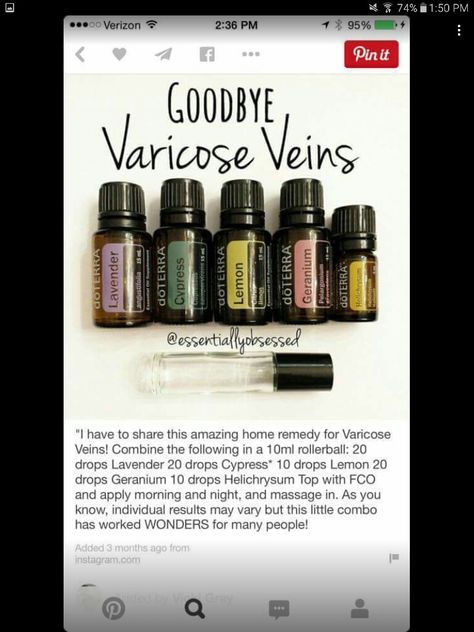 Varicose veins Essential Oils For Varicose Veins, Varicose Veins Essential Oils, Varicose Vein Remedy, Doterra Essential Oils Recipes, Essential Oil Remedy, Essential Oils Guide, Oil Remedies, Essential Oils Health, Essential Oil Roller Bottle