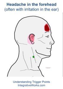 fi-headache-in-the-forehead-with-ear-irritation Acupressure Headache, Forward Head Posture Exercises, Ear Pressure, Acupuncture Benefits, Ear Ache, Neck And Shoulder Muscles, Forward Head Posture, Posture Exercises, Headache Relief