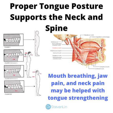 Orofacial Myofunctional Therapy, Tongue Thrust, Myofunctional Therapy, Facial Bones, Facial Therapy, Teeth Grinding, Jaw Pain, Spine Health, Tongue Tie