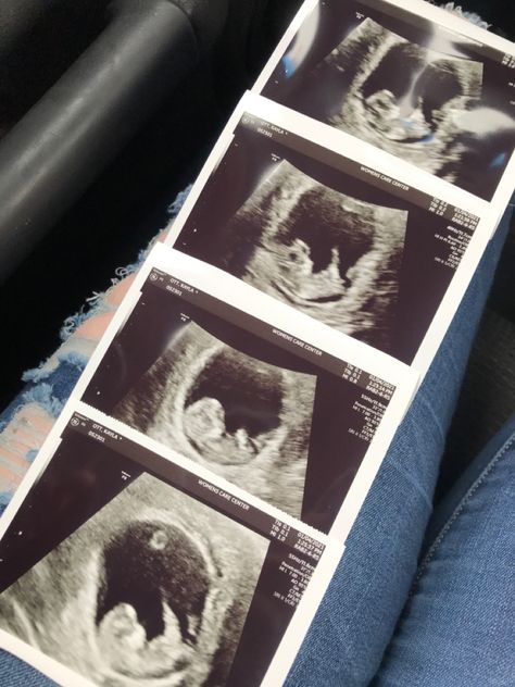 Baby Ultrasound Pictures, Tumblr Stories, Hospital Admit Hand Pics, Baby Ultrasound, Bollywood Music Videos, Ultrasound Pictures, Baby Tumblr, Mommy Goals, Ulzzang Kids