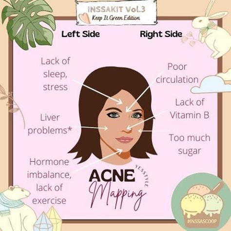 Foods For Clear Skin, Blind Pimple, Pimples Under The Skin, Acne Soap, Acne Toner, Bad Acne, Pimples On Face, Acne Face, Types Of Acne