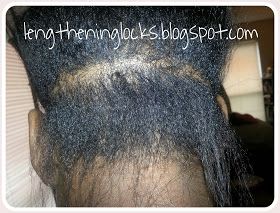 Lengthening Locks: Nape Damage and Recovery Natural To Relaxed Hair, Healthy Relaxed Hair, Hair Regimen, Pelo Afro, Black Hair Care, Relaxed Hair, Hair Breakage, Hair Maintenance, Damaged Hair