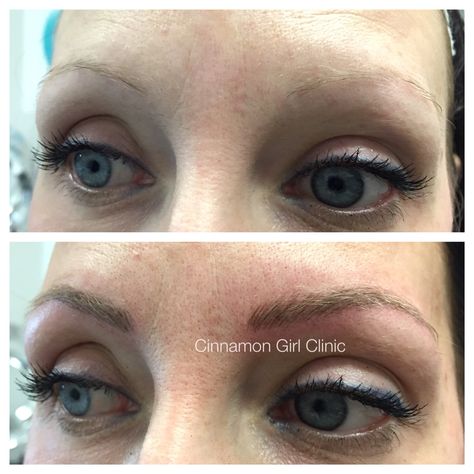 Blonde eyebrow tattooing! www.cinnamongirlclinic.ca Microbladed Eyebrows, Blonde Eyebrows, Eye Brows, Long Face, Microblading Eyebrows, Eyebrow Tattoo, Long Faces, Short Pixie, Permanent Makeup