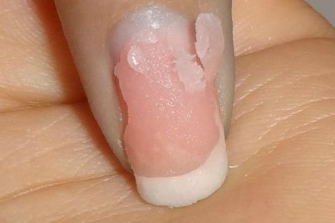 Soak Off Acrylic Nails, Take Off Acrylic Nails, Smart Nails, Solar Nails, Remove Acrylics, Remove Acrylic Nails, Acrylic Nails At Home, Nail Soak, Nail Remover