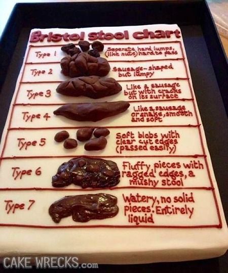 Bristol Stool Chart Cake, Poop Cake, Bristol Stool, Medical Cake, Stool Chart, Bristol Stool Chart, Stool Sample, Nursing Cake, Cake Wrecks