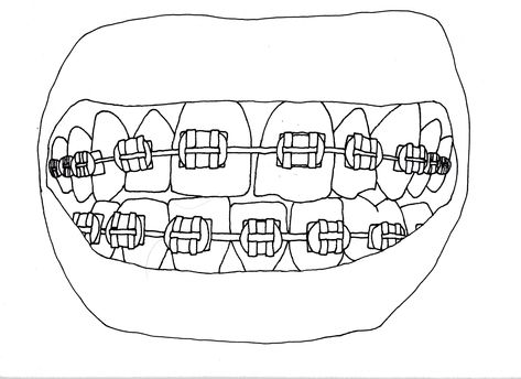 Braces Line Drawing by Sarah Norman Braces Mouth Drawing, Teeth With Braces Drawing, How To Draw Braces On Teeth, Smile With Braces Drawing, Dentistry Drawing, Braces Tattoo, How To Draw Braces, Braces Illustration, Drawing Braces