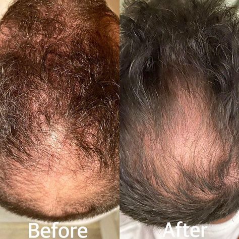 Monat Hair & Skin Testimonials on Instagram: “@motivatedcouple719 sharing her husbands Monat Hair Testimonial • • • • • • • "I want to share my husbands positive feedback with Monat. He…” Monat Hair, Hair Skin, Positive Feedback, I Want, To Share, Skin, Hair, On Instagram, Quick Saves