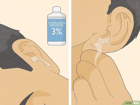 How to Remove Water from Ears: 12 Simple Tricks to Try How To Remove Water From Ear, Water Stuck In Ear, How To Clear Clogged Ears, Water In Ear How To Get Rid Of, How To Unclog Ears, Get Water Out Of Ear, How To Get Water Out Of Your Ear, Swimmers Ear Remedy Kids, Water In Ear Remedy