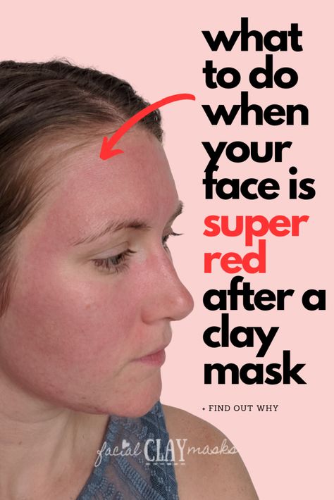 Is Redness after a clay mask normal?  Redness after using a powerful clay mask is normal. It should not get painful and improve within half an hour. This draws blood to the surface of skin and provide oxygen and nutrients. Red Clay Mask, Redness Face, Aztec Clay Mask, Clay Recipes, Aztec Clay, Bentonite Clay Mask, Congested Skin, Routine Tips, Clay Face Mask