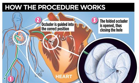 Hole In Heart, Heart Defect, The Dating Divas, Dating Divas, Cardiology, Head Start, One Month, Things To Know, A Heart