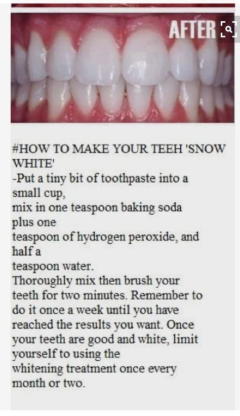 Baking Soda Teeth Whitening, Baking Soda Toothpaste, Dairy Foods, Toothpaste Recipe, Kindergarten Graduation Party, Natural Botox, Moisturizing Body Oil, Teeth Whitening Diy, Gift Ideas For Everyone