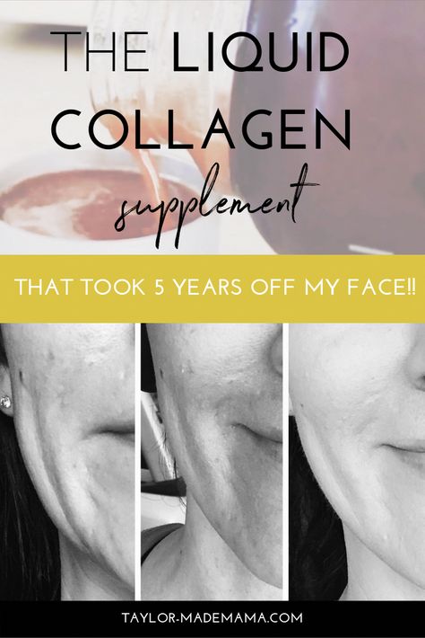 Liquid Collagen Products, Rejuvicare Collagen, Liquid Collagen Before And After, Best Collagen For Women, Liquid Collagen Benefits, Best Liquid Collagen, Modere Collagen, Modere Trim, Health Benefits Of Collagen