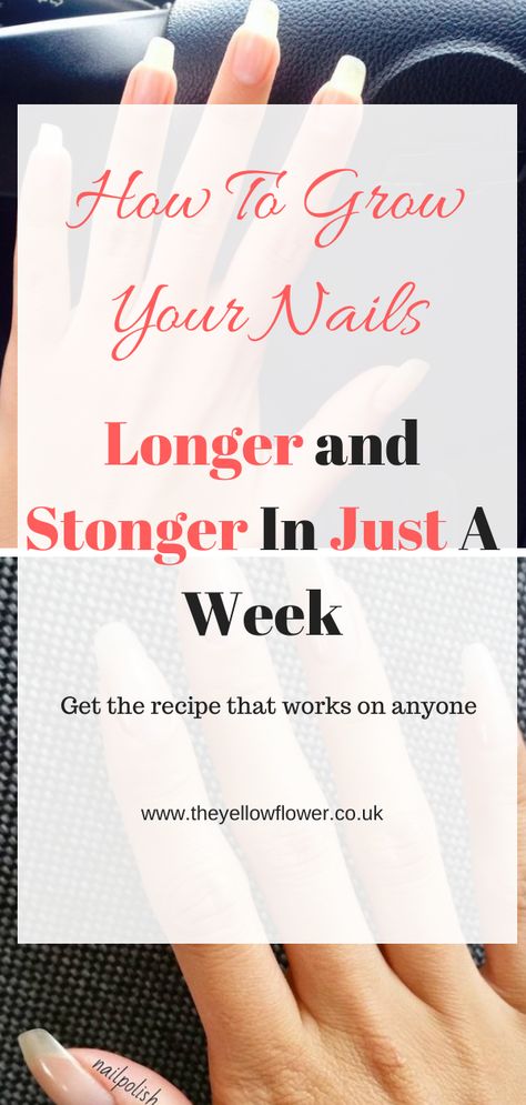 Grow Your Nails Faster, Grow Long Nails, Nail Growth Tips, Grow Nails Faster, How To Grow Your Hair Faster, Tongue Health, Nail Care Tips, How To Grow Nails, Brittle Nails