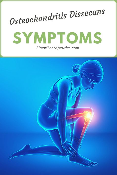 Symptoms of Osteochondritis Dissecans Osgood Schlatter Disease, Patellofemoral Pain Syndrome, Iliotibial Band, Knee Pain Remedy, Knee Pain Exercises, Knee Exercises, Knee Pain Relief, Joints Pain Relief, Sports Medicine