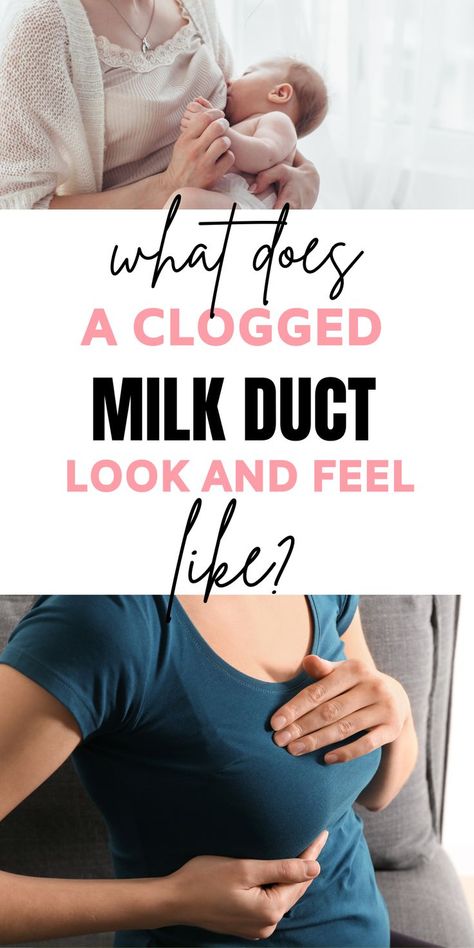 What Does A Clogged Milk Duct Look and Feel Like? Milk Ducts Anatomy, How To Unclog Milk Ducts, Blocked Milk Duct Remedies, Breastfeeding Pain Relief, How To Get Rid Of Clogged Milk Ducts, How To Clear A Clogged Milk Duct, Clogged Milk Duct Remedies, Clogged Milk Duct Symptoms, Milk Duct Clog