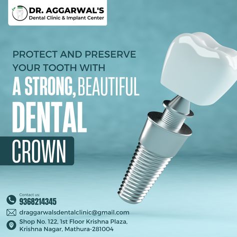 Dental Care Creative Ads, Dental Implants Creative Ads, Dental Infographics, Medical Ads, Dental Content, Dental Post, Dental Ads, Dental Ideas, Bio Data For Marriage