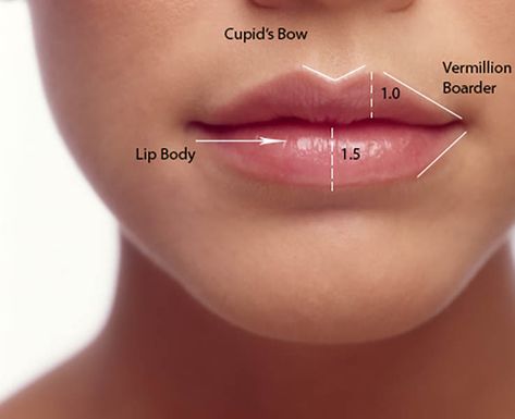 Bow Shaped Lips Filler, Lips With Cupids Bow, Bow Lips Shape, Vermillion Border Lip Filler, Soft Lip Filler, Where To Inject Lip Filler, Lip Filler Inspiration Small Lips, Lip Filler Cupids Bow, Best Lip Shape