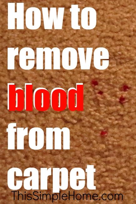 How to remove blood stains from carpet Blood Out Of Carpet, Remove Blood Stains, Blood Stain Removal, Clean Car Carpet, Carpet Cleaning Business, Deep Carpet Cleaning, Cleaning Stuff, Diy Carpet Cleaner, Carpet Cleaning Solution