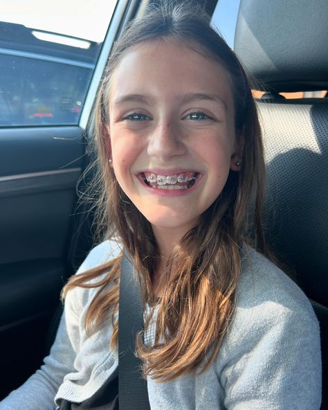 BIG smiles for London today as she got her braces off! 😁😁😁 It’s amazing the change in just 10 months - the last two pictures are the day she got them on last fall! Braces Smile, Braces Off, Big Smiles, London Today, Change In, The Change, Braces, The Day, London