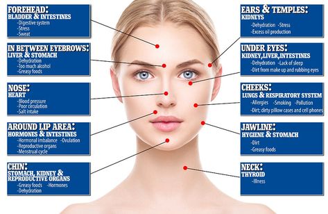 Skin professionals can use your face as a map to detect a plethora of issues - from dehydration, to stress, to breathing problems, to hormonal fluctuations, and more. Here, we break it down. Break Out Zones Face, 12 Meridians, Face Mapping Acne, Professional Skincare, Aesthetic Dermatology, Body Toxins, Skin Diet, Face Mapping, Acne Face