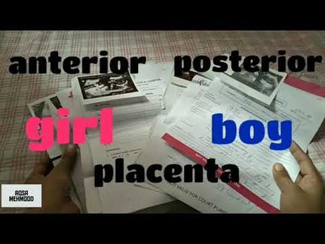 Anterior Placenta Gender Prediction, 4 Months Pregnant Belly, Baby Gender Ultrasound, Ultrasound Gender Prediction, Anterior Placenta, Ultrasound Gender, 4 Months Pregnant, Baby Gender Prediction, Gender Prediction