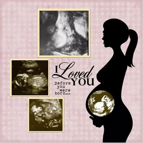 Ultrasound Scrapbook, Pregnancy Scrapbook, Boy Scrapbook Layouts, Custom Scrapbook, Baby Scrapbook Pages, Scrapbooking Layouts Baby, Baby Layouts, Ultrasound Pictures