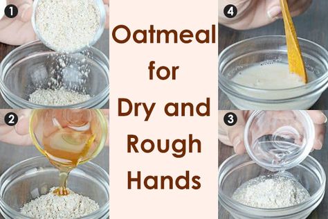 Rough Hands Remedy, Hand Soak For Dry Hands Diy, Hand Soak For Dry Hands, Cracked Hands Remedy, Chapped Hands Remedy, Dry Hands Remedy, Dry Skin Home Remedies, Extremely Dry Hands, Softer Hands