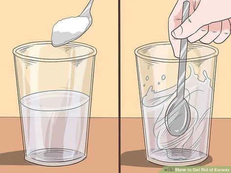 4 Ways to Get Rid of Earwax - wikiHow Ear Cleaner For People, Diy Ear Wax Removal Remedies, Remove Earwax At Home, Clean Ears Wax How To Remove, Earwax Removal Diy, How To Clean Your Ears Out, Ear Cleaning Solution For People, How To Clean Ear Wax Out, Natural Ear Wax Removal