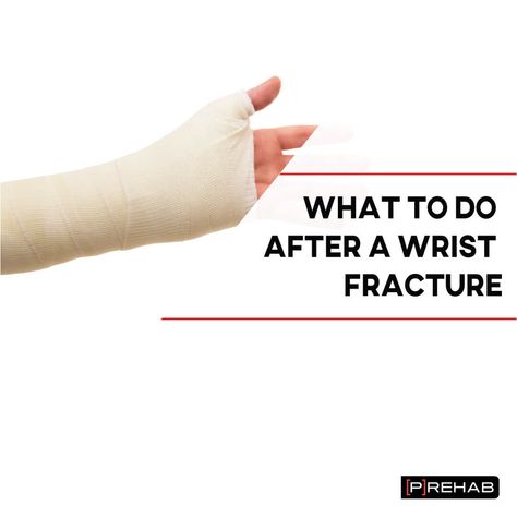 What To Do After A Wrist Fracture Wrist Rehab Exercises, Wrist Fracture Exercises, Wrist Surgery Recovery, Wrist Fracture, Scaphoid Fracture, Hand Fracture, Finger Circle, Sprained Wrist, Wrist Stretches