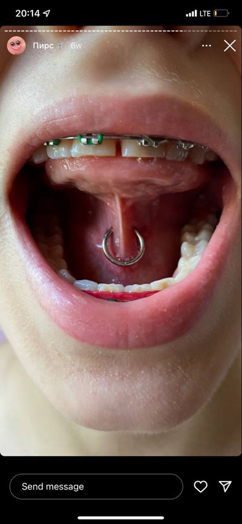 Types Of Tounge Piercings, Weird Piercings, Piercings Face, Piercing Inspo, Body Modification, Body Modifications, Hoop Ring, Piercing Jewelry, Braces