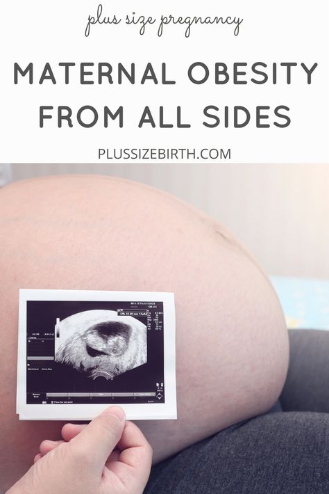 Maternal Obesity from All Sides: An Interview with Kimmelin Hull | Plus Size Pregnancy | Plus Size and Pregnant | Fat and Pregnant Obese And Pregnant, Pregnancy Plus Size, Obese Pregnancy, Plus Size Peplum Dress, Twins Pregnancy, Plus Size Jumpers, Baby Bump Photos, Plus Size Tips, Pregnancy Body