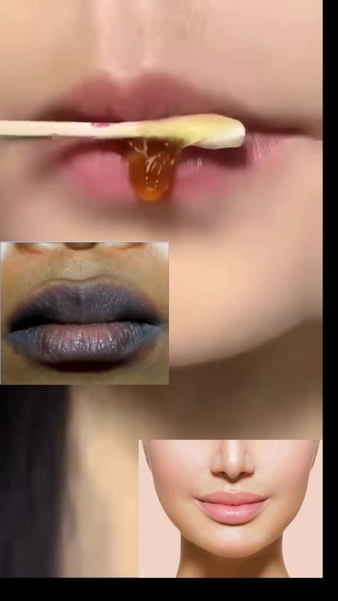 Lip tan removing || Home Remedies tips || #fypシ #short #shortsvideos #trending #trendinghacks #viralreels #reelsfb #diy | Pooja Nagwal | Jeonghyeon · Losing Lip Tan Removal, How To Remove Tan From Lips, How To Remove Hair Above Lips, Instant Tan Removal Home Remedies, Easy Way To Remove Tan, Tan Removal Home Remedies, Tanning, Home Remedies, Facial