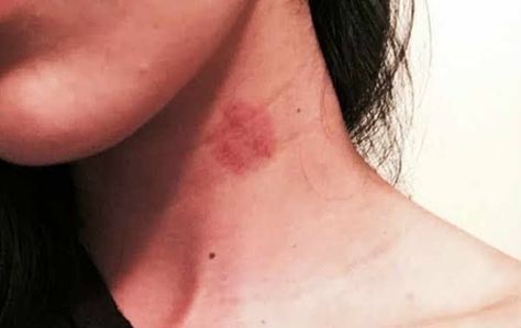 Hickies Neck Aesthetic Girl, Hickies Neck, Formal Dresses For Men, Friendship Photography, Beautiful Eyes Pics, Gym Guys, Beautiful Quran Verses, Girls Dp Stylish, Beauty Mark