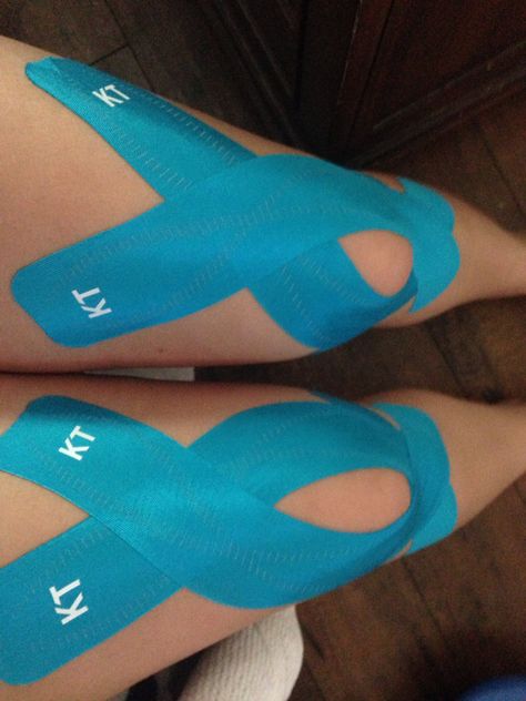 KT tape for Patellar tracking Kt Tape For Patellar Tracking, Kt Tape Knee Patella, How To Put Kt Tape On Your Knee, Knee Kt Taping, Kinesiology Taping Knee, Kinesio Taping Knee, Kt Tape Knee, Knee Taping, K Tape