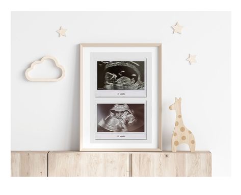 Baby scan frame