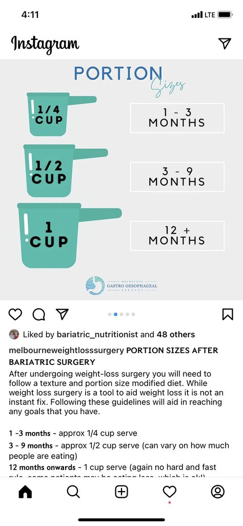 Portion Size After Vsg, Bariatric Diet 1 Year Post Op, Gastric Bypass Shopping List, Bariatric Portion Size, Gastric Bypass Tips And Tricks, Vsg Post Op Week 1, Bariatric Tips And Tricks, Full Liquid Diet Bariatric Post Op, Vsg Before And After