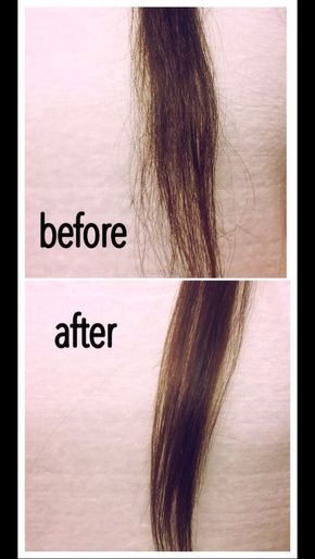 Hair Smooth, Coconut Oil Hair, Hair Remedies, Unwanted Hair Removal, Unwanted Hair, Hair Repair, Crazy Hair, Smooth Hair, Hair Care Tips