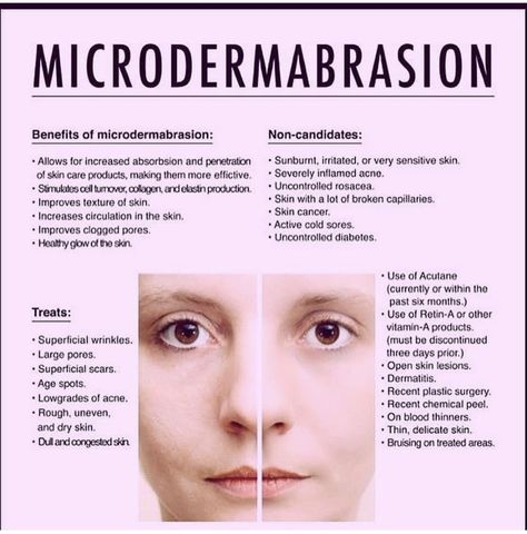 Esthetician Services, Esthetician Notes, Microdermabrasion Facial Steps, Facial Cosmetic Procedures, Facial Treatments Professional, Microdermabrasion Facial Benefits, Esthetician Facial Protocol, Esthetician Facts Skincare, Microdermabrasion Benefits