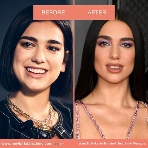 Plastic Surgery Gone Wrong, Face Surgery, Physical Examination, Informed Consent, Risk Assessment, Celebrity Plastic Surgery, Chic Fall Outfits, The Kardashians, After Surgery