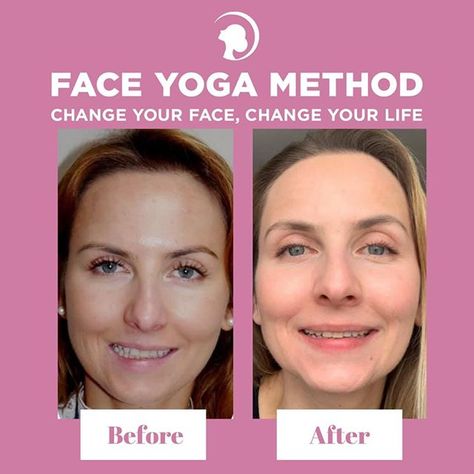 face yoga, facial exercises, face exercises Symmetrical Face Exercises, Symmetry Face, Symmetrical Face, Sagging Cheeks, Face Massage Anti Aging, Face Yoga Method, Facial Exercise, Muscles Of The Face, Face Yoga Exercises