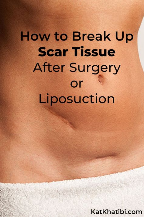 How To Break Up Scar Tissue After Surgery or Liposuction - Kat Khatibi Podcast and Wellness Blog [Health - Happiness - Beauty] Scar Tissue Removal, Scar Tissue Massage, Plastic Surgery Recovery, Scar Massage, How To Break Up, Oils For Scars, C Section Scars, Growing Healthy Hair, Body Hacks